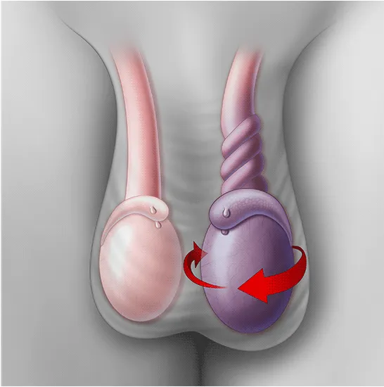 testis bengkak