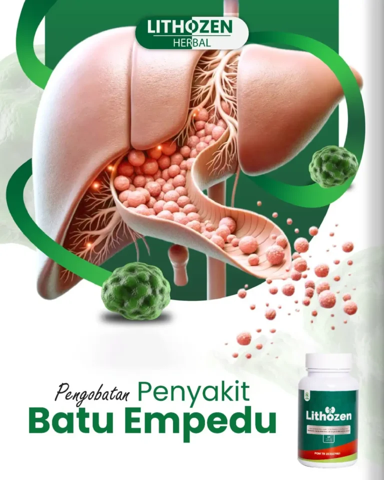 obat batu empedu